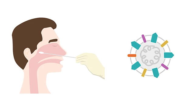 Describing antigen testing for patients with COVID-19 | Medmastery