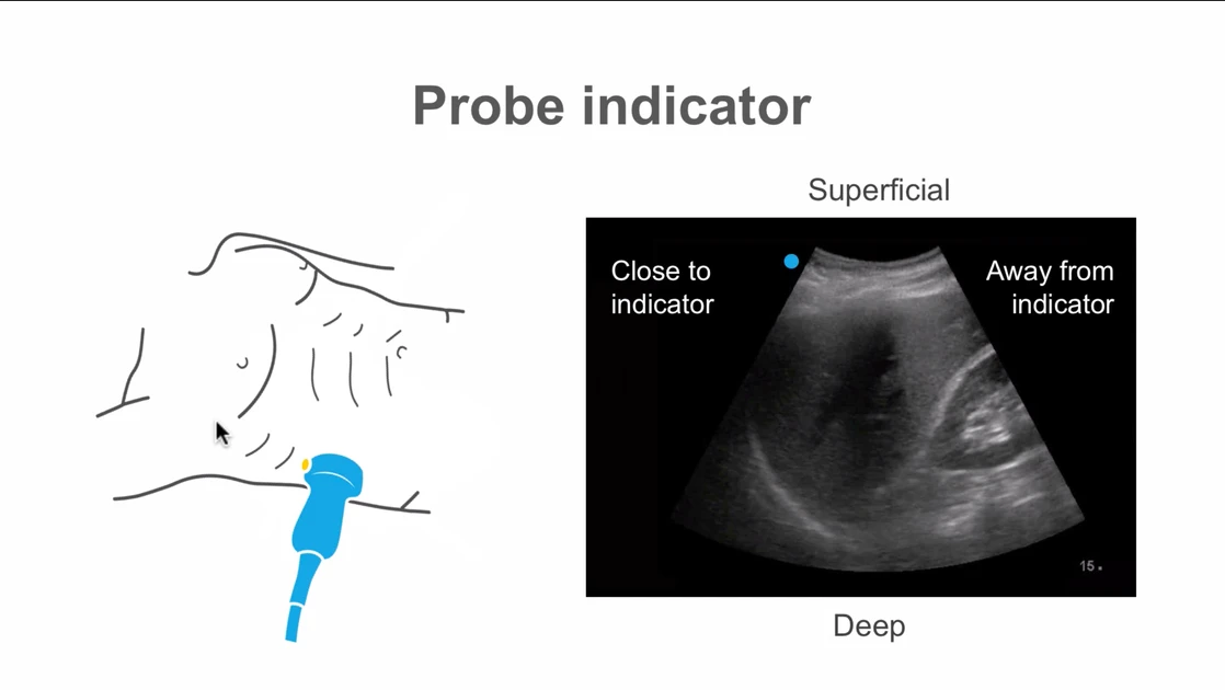 Navigating the ultrasound machine before an invasive procedure | Medmastery