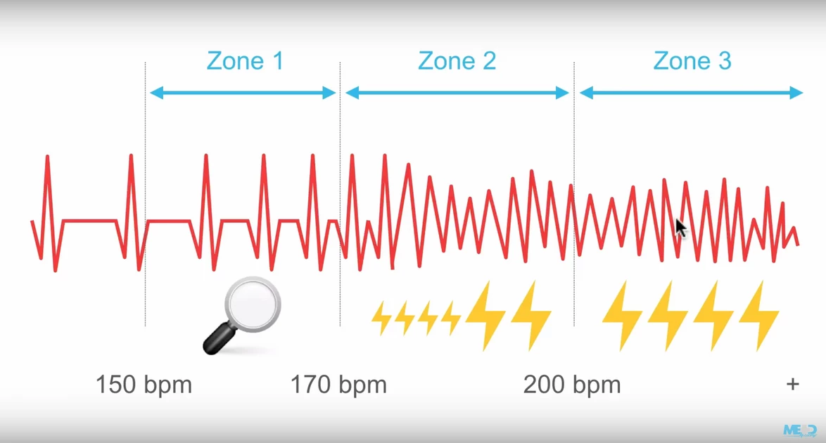 Mastering Defibrillation The Ultimate Guide - ilodfze