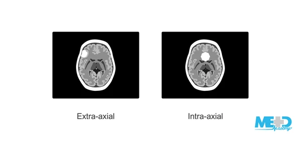 Distinguishing between intra- and extra-axial tumors on