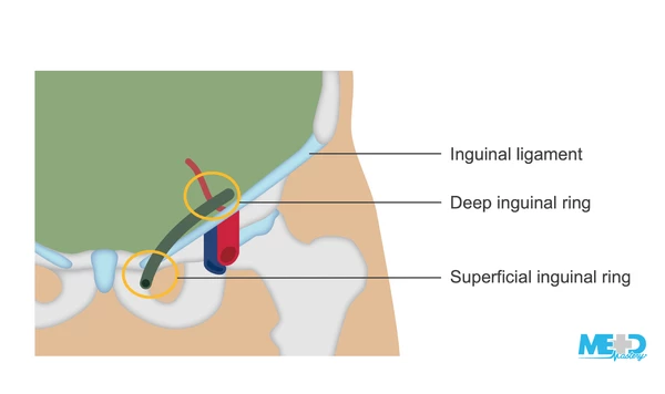 How to examine the inguinal region